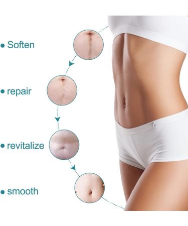 Premium Silicone Scar Removal Band - 1.6 x 60 Rolls | Effectively Treat Old & New Scars Keloids & Acne Scars - Fast International Shipping - Buy Online on GoSupps.com
