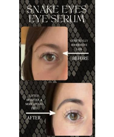 Intoxicated Cosmetics Snake Eyes Eye Serum 15 ml - Bakuchiol Under Eye Solution for Women and Men - Lift | Tighten | Brighten - Buy Online on GoSupps.com