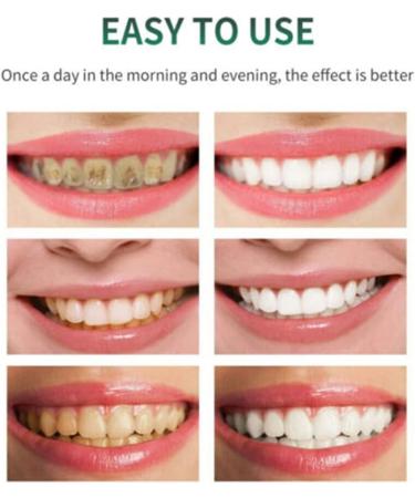 Teeth Whitening Mousse Teeth Whitening Foam Toothpaste Intensive Stain Removal Toothpaste Cleansing Foam Best Whitening Toothpaste Travel Friendly Easy To Use Ultra-fine Mousse Foam (3) - Buy Online on GoSupps.com