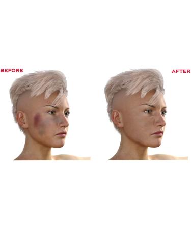 BruiseGONE - Fast-Acting Natural Bruise Remedy | Heal Bruises One Week Quicker | Essential Oil Blend | Easy to Use & Absorb - Buy Online on GoSupps.com