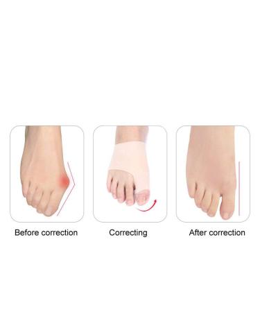 Buy Bunion Toe Corrector - 2 Pairs Elastic Breathable Hallux Valgus Separator for Men & Women - Effective Bunion Pain Relief - Buy Online on GoSupps.com