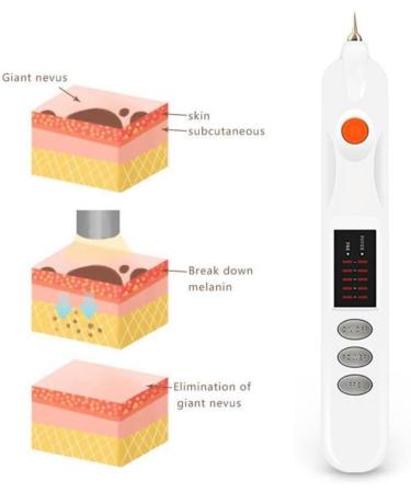 Plexr Energy Arc Treatment Kit Solution for Eyelids Lifting Fine Wrinkle Pore Lifting Skin Tightening Face Toning - Buy Online on GoSupps.com