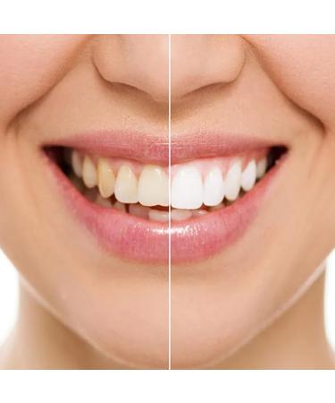 DENIVIT Set 12 DENIVIT Smokers Toothpaste Anti-stain 50 ml - Toothpastes - Buy Online on GoSupps.com