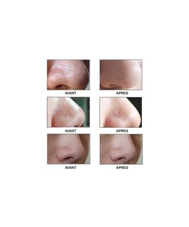 Dahlia Skincare Blackhead Cleaner - Effective Solution for Clear Skin | International Shipping Available - Buy Online on GoSupps.com