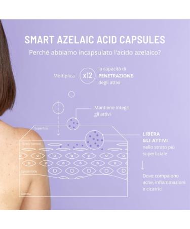 Freshly Cosmetics Azelaic Active Body Treatment Acne Serum 100ml - Buy Online on GoSupps.com