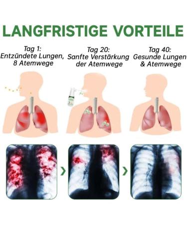 Lovilds Herbal Cleaning & Repair Spray - Two-Piece Set for Dinner & Lung Purification - International Shipping Available - Buy Online on GoSupps.com