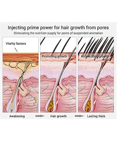 Herbal Rolling Ball Massage Hair Growth Serum - 2PC Scalp Oil for Regrowth & Anti-Hair Loss - Buy Online on GoSupps.com