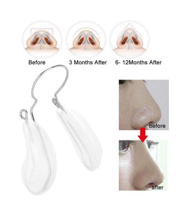 Nose Up Clip - Enhance Your Nose Shape & Lift with Our Beauty Reshaper for Wide & Crooked Noses - International Shipping Available - Buy Online on GoSupps.com