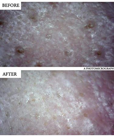 Vegan Beauty Blackhead & Whitehead Remover - BONAJOUR Sebum Cleansing Gel | Deep Pore Cleanse with Natural Ingredients - 3.5 fl. oz - International Shipping - Buy Online on GoSupps.com