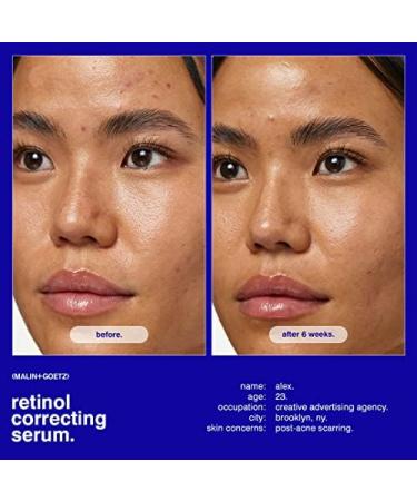 Malin + Goetz Retinol Correcting Serum 1oz Brightening Anti-Aging Face Serum for Sensitive Skin Vegan & Cruelty Free - Buy Online on GoSupps.com
