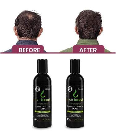 VYTALIVING Hairboost Caffeine Power Tonic for Men 200ml - Hair Treatment For Men - Energising and Stimulating - Hair Vitamins for Growth and Hair Loss - Hair Growth Serum - For All Hair Types of Men - Buy Online on GoSupps.com