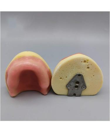 Fhuili Dental Implant Practice Model - Gum-Free Distental Model for Advanced Training - Buy Online on GoSupps.com