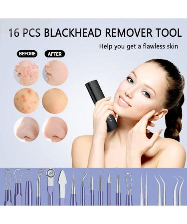 Xesscare 16 Pcs Pimple Popper & Blackhead Remover Tool Kit - Professional Acne Extraction Set with Metal Case - Purple - Buy Online on GoSupps.com