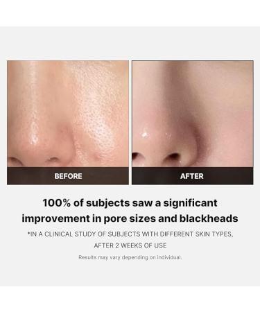 Medicube Zero Pore Pads 2.0 - Dual-Textured Facial Toner Pads for Exfoliation and Minimizing Pores with 4.5% AHA Lactic Acid & 0.45% BHA Salicylic Acid - Ideal for All Skin Types - Korean Skin Care - Buy Online on GoSupps.com
