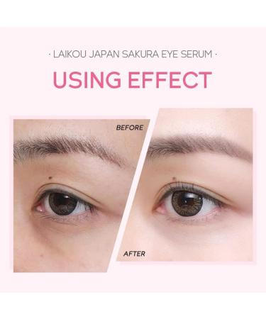 15ml Sakura Eye Serum Eye Roller Massage Hydratant Anti- ge Rides Supprimer les cernes Lisser les poches Ridules Raffermissant Soins des yeux (3PCS) - Buy Online on GoSupps.com