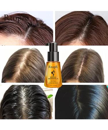 RtopR Moroccan Hair Essential Oil for Hair Loss Prevention - Dry Damaged Hair Care for Men and Women - Healthier Scalp Treatment for Shine and Gloss - Buy Online on GoSupps.com