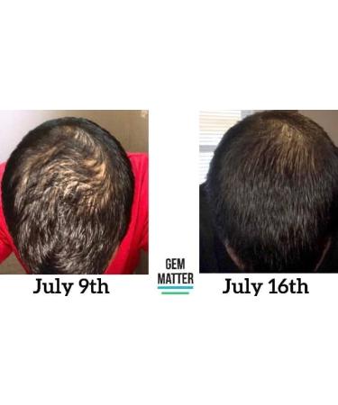 Premium Restorative Oil for All Skin Types | Shop Internationally - Buy Online on GoSupps.com