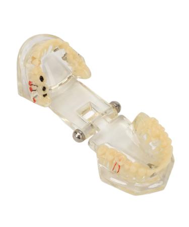 Verdant Touch Transparent Dental Implant Model Transparent Dental Implant Pathology Model for Teaching Aids