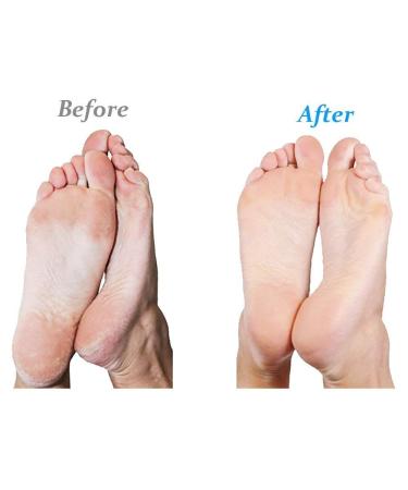 Emjoi Micro-Pedi Refill Rollers (Pack of 8 Extra Coarse) - Smoother, Softer Feet Guaranteed - Buy Online on GoSupps.com