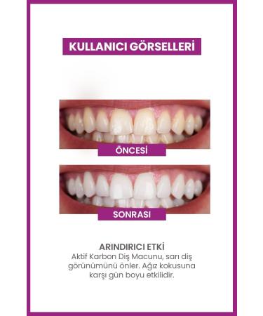 Luis Bien Activated Charcoal Toothpaste for Whiter Teeth and Fresher Breath - Removes Stains and Yellowing of Teeth - Buy Online on GoSupps.com