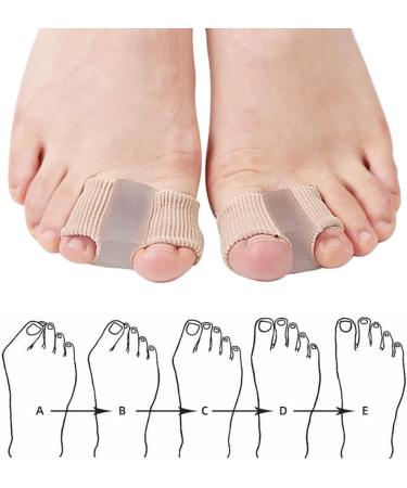Silicone Toe Extensors & Spreaders for Hallux Valgus - 2-Piece Corrective Toe Separator for Men & Women - Buy Online on GoSupps.com