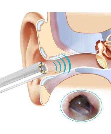 2021 Smart Ear Cleaning Kit with HD Otoscope Camera for Children and Adults - Ear Wax Removal Endoscope and Tools - Buy Online on GoSupps.com