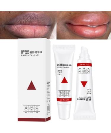 Lip Balm for Dark Lips, Fresh Pink Lip Balm Whitening Cream, Lip Balm for Smokers, Lip Balm for Men and Women 15ml (1pcs)