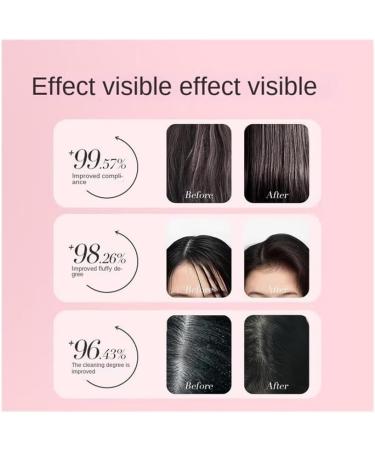 Anti-dandruff Shampoo For Teenagers 12 Years Old And Above Children's Shampoo For Boys And Girls Anti-itching Shampoo For Older Children Girls' Lightweight Shampoo 350ml (32-33 3435 36-37 38 - Buy Online on GoSupps.com