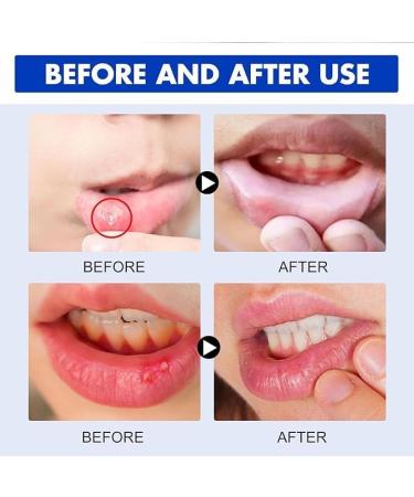Oral Relief Spray - Canker & Dry Mouth Relief | Moisturizing Oral Care Spray - Buy Online on GoSupps.com