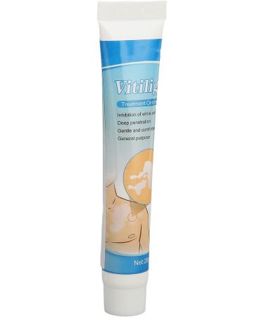 Vitiligo Treatment Cream for White Spots & Skin Pigmentation 0.7oz - Herbal Extract Ointment - Buy Online on GoSupps.com