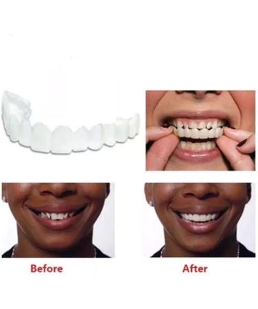Buy Muyey Silicone Fake Teeth Set - Upper & Lower Dental Care Teeth Whitening Oral Hygiene Solutions - Buy Online on GoSupps.com