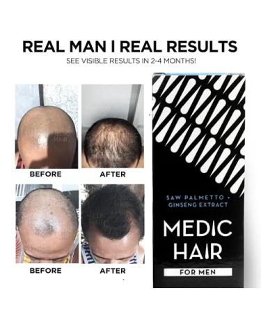 Medic Hair for Men 90ml - DHT Blocking Saw Palmetto & Ginseng Extract - Natural Hair Growth Solution | 3.04 fl oz - Buy Online on GoSupps.com