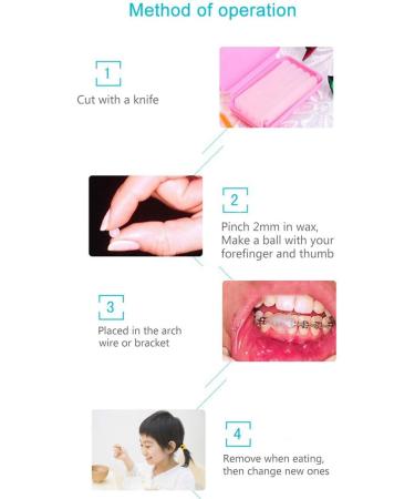 RZJZGZ Dental Wax for Braces Dental Oral Care Orthodontics Wax for Braces with Fruit Smell for Brace Wearers Gum Protection- 6 Boxs for 300 Times 5 Count (Pack of 6) - Buy Online on GoSupps.com