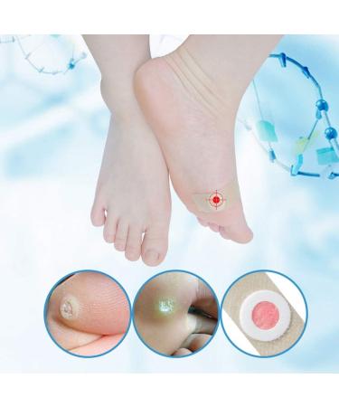 Wart Remover Corn Remover Foot Corn Remover Pads Plantar Wart Removal Corn Callus Remover Penetrates and Removes Common and Plantar Warts Callus Stops Wart Regrowth 20PC - Buy Online on GoSupps.com