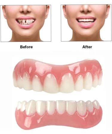 Temporary Dental Veneers for Natural Teeth Restoration - Upper & Lower Jaw, Natural Shade - Buy Online on GoSupps.com