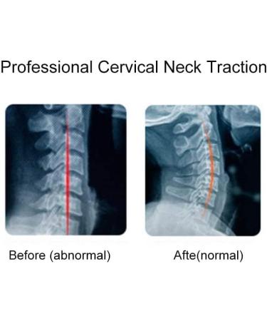 Safwel Neck Support: Adjustable Hinges & Cervical Tractor for Pain Relief - Ideal for Men & Women - Buy Online on GoSupps.com