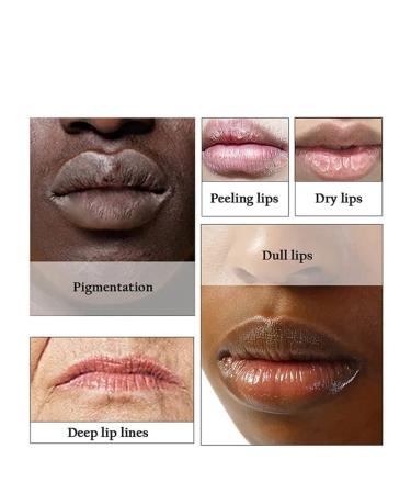 Lip Lightening Scrub Balm Duo | Moisturizing & Anti-Aging Formula with Hyaluronic Acid | Brighten Dark Lips - Buy Online on GoSupps.com