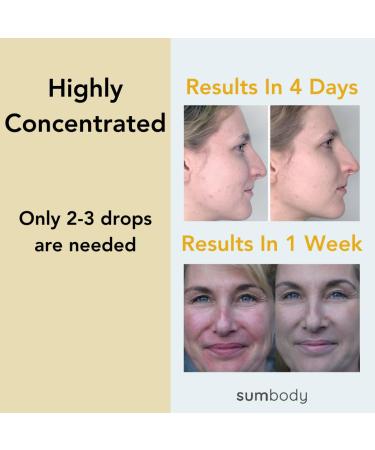 Rebel Skin Care Face Serum for Blemishes & Scars - All Natural 15ml Oil for Women & Men Acne Spot Reducer - Made in USA - Buy Online on GoSupps.com