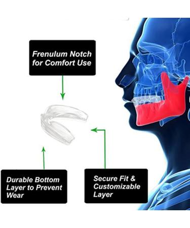 Anti Grinding Teeth Night Guards 3Pcs M White - Mouth Guard for Grinding Teeth, Clenching, Sleep Aid - Buy Online on GoSupps.com