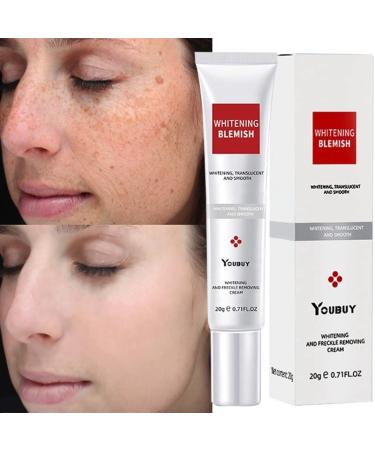 Axnoocy Face Cream Dark Spot Rem ver  Instant Results Blemish Melasma Freckle Sun Spots Removal Cream for Women Men  Suitable for All Skin Types (0.71fl.oz) White