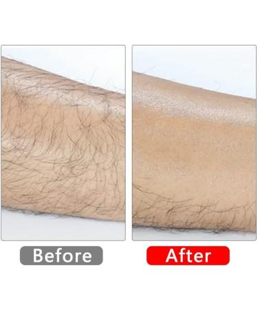 Jasni Crystal Hair Remover Stone Painless Exfoliation Hair Removal Tool Nano Crystal Hair Eraser for Women Men Physical Epilator Trimmer for Arms Legs Back Fast Easy Exfoliate (black+blue) - Buy Online on GoSupps.com