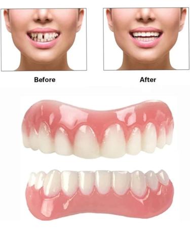 2 Sets Elastic Teeth - Temporary Tooth Cover for Imperfect Teeth - Natural Shade, Comfortable Fit - Buy Online on GoSupps.com
