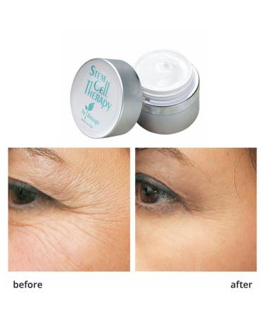 Stem Cell Therapy by Biologic Solutions - Rejuvenate Skin Grow Smooth & Firm - Set of 2 Jars - International Shipping Available - Buy Online on GoSupps.com
