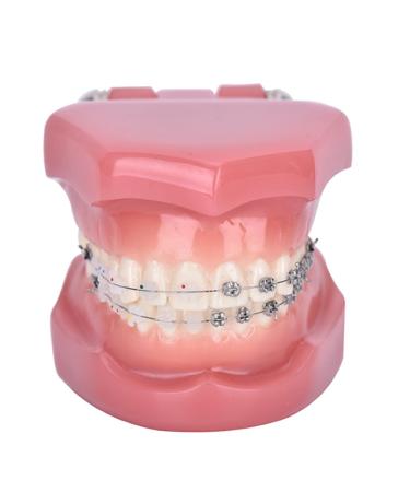 Dytah 1: 1 demonstration orthodontic treatment teeth model patient communication laboratory teach study tools with metal and ceramic bracket adult standard demonstration