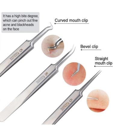 WNPXQNT Spuer-fine No. 5 Cell Pimples Blackhead Clip Tweezers Professional Acne Tools Beauty Remover and Pimple Accessories Salon Spots No. 5 Oblique Mouth Clip With Box One Size - Buy Online on GoSupps.com
