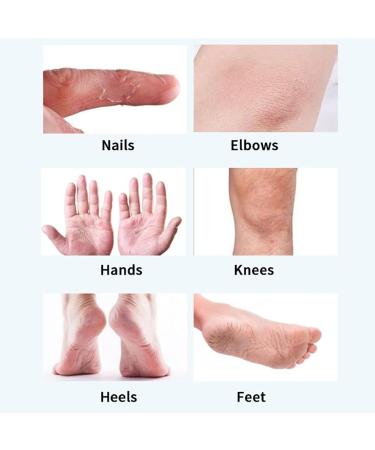 Mrinb 50g Foot Cream - Very Dry Feet Cream to Moisturize Deeply in the Skin Repairs Cracks and Softens Calluses - Buy Online on GoSupps.com