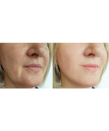 Neuropeptide & Growth Factor Wrinkle Serum - Brightening Antioxidant Collagen Peptides & Hyaluronic Acid for All Skin Types - Reduce Fine Lines & Premature Aging - 1oz - Buy Online on GoSupps.com