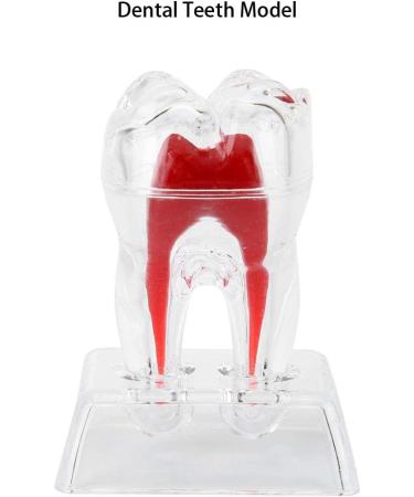 Discriminable Toothed Tooth Model for Endodontics | Plastic Teeth Teaching Material for Dental Studies & Research | International Shipping Available - Buy Online on GoSupps.com