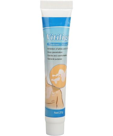 Vitiligo Cream 30G - Herbal Extract Treatment for White Spots & Skin Pigmentation - Creme Medix Leukoplakia Solution - 0.7oz - Buy Online on GoSupps.com