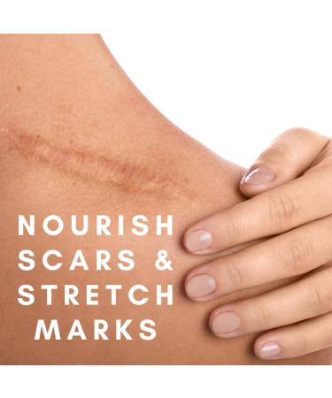 True Moringa Shea & Moringa Balm | Scar & Stretch Mark Repair | Intensive Hydrating Cream for Dry & Sensitive Skin | Unscented | 2oz - Shop Now - Buy Online on GoSupps.com